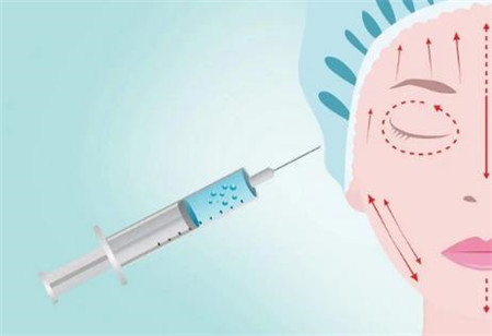 面部凹陷的填充方法有哪些?